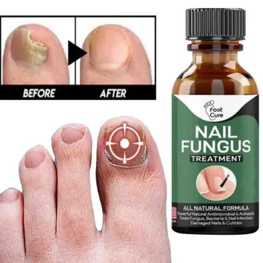Nail Fungal Treatments Nail Repair Essences Serum Care Treatments Foot Nail Fungus Removal Gel