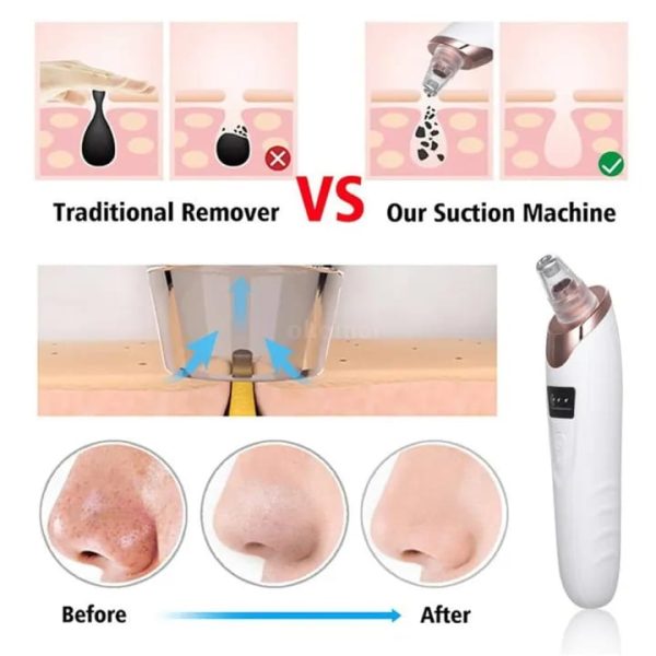 Blackhead Remover Pore Cleaner | Electric Deep Cleansing Tool For Nose & Face