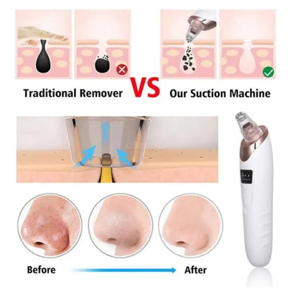 Blackhead Remover Pore Cleaner | Electric Deep Cleansing Tool For Nose & Face
