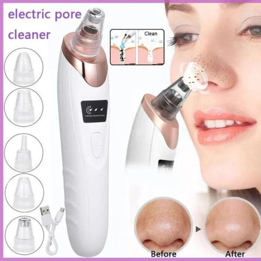 Blackhead Remover Pore Cleaner | Electric Deep Cleansing Tool For Nose & Face