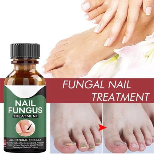 Nail Fungal Treatments Nail Repair Essences Serum Care Treatments Foot Nail Fungus Removal Gel